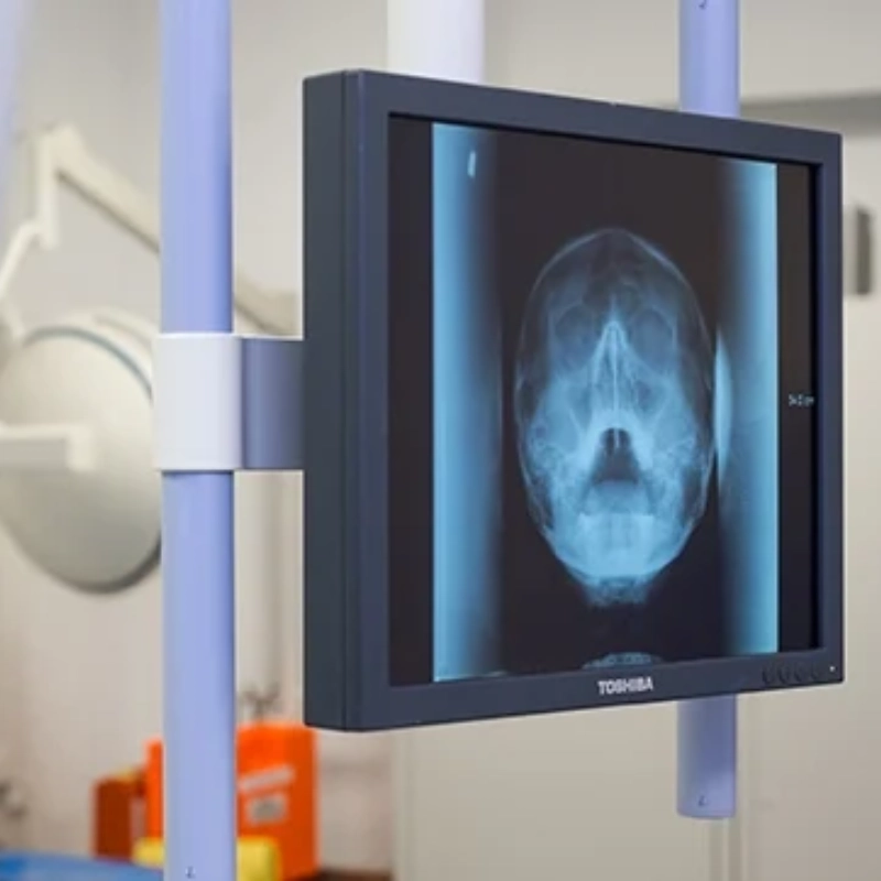 Онкология головы и шеи